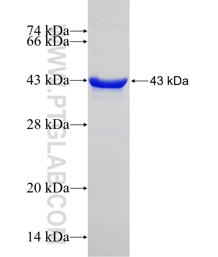 ALK,CD246 fusion protein Ag21493 SDS-PAGE