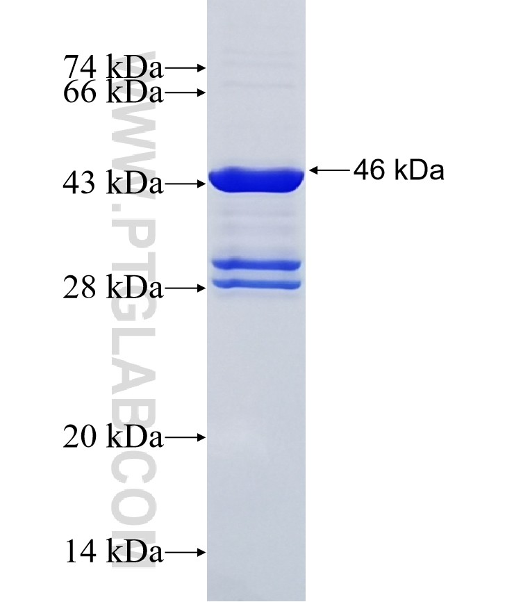 ALKBH1 fusion protein Ag27520 SDS-PAGE