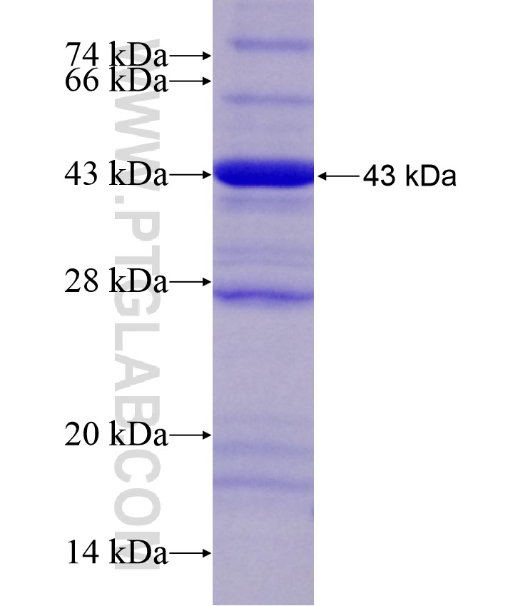 ALKBH1 fusion protein Ag17548 SDS-PAGE ALKBH1 fusion protein Ag17548 SDS-PAGE
