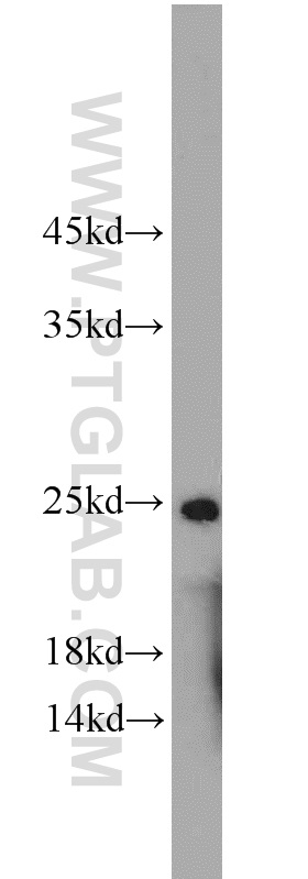 ALKBH3 Polyclonal antibody