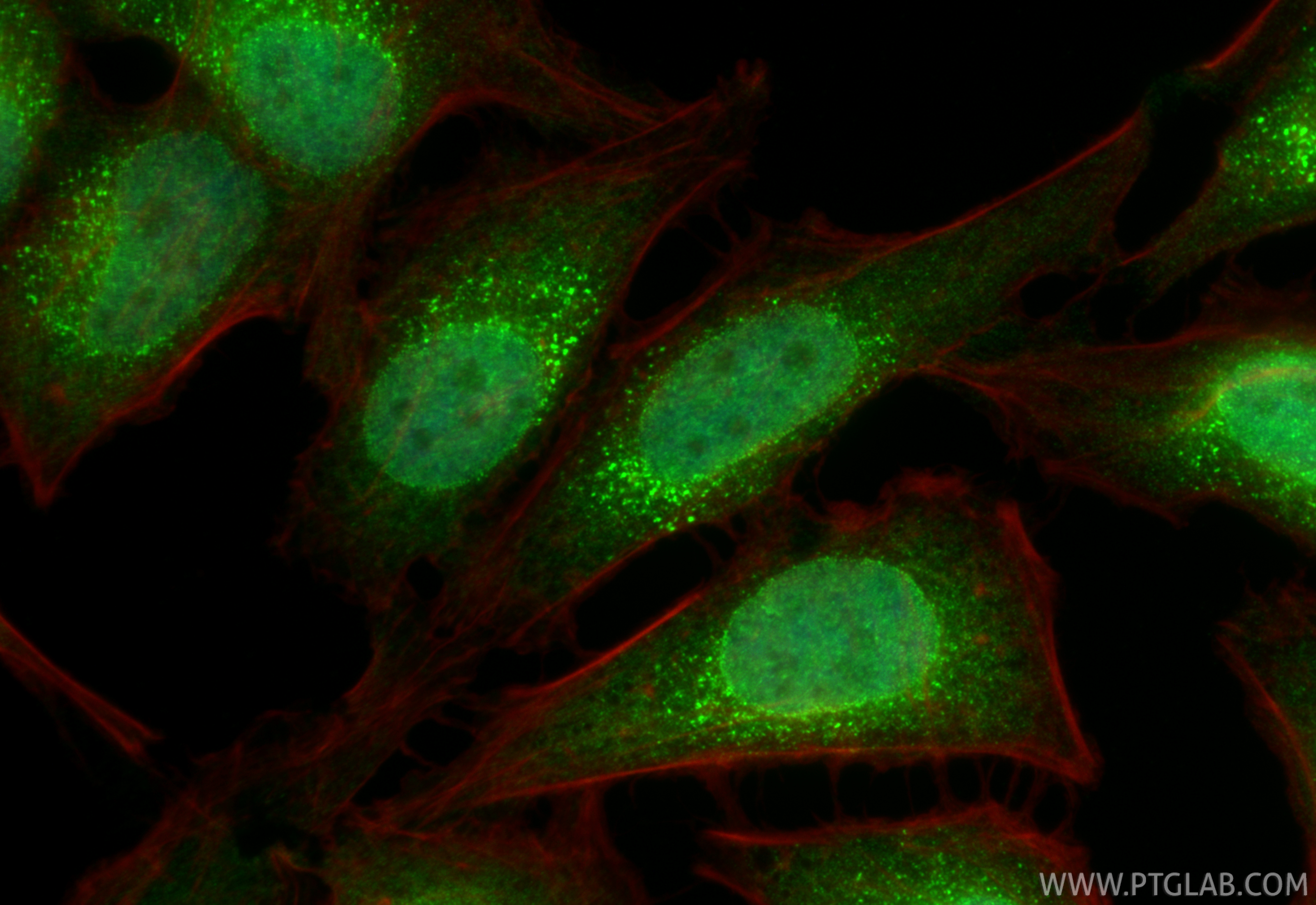 IF Staining of HeLa using 84314-2-RR