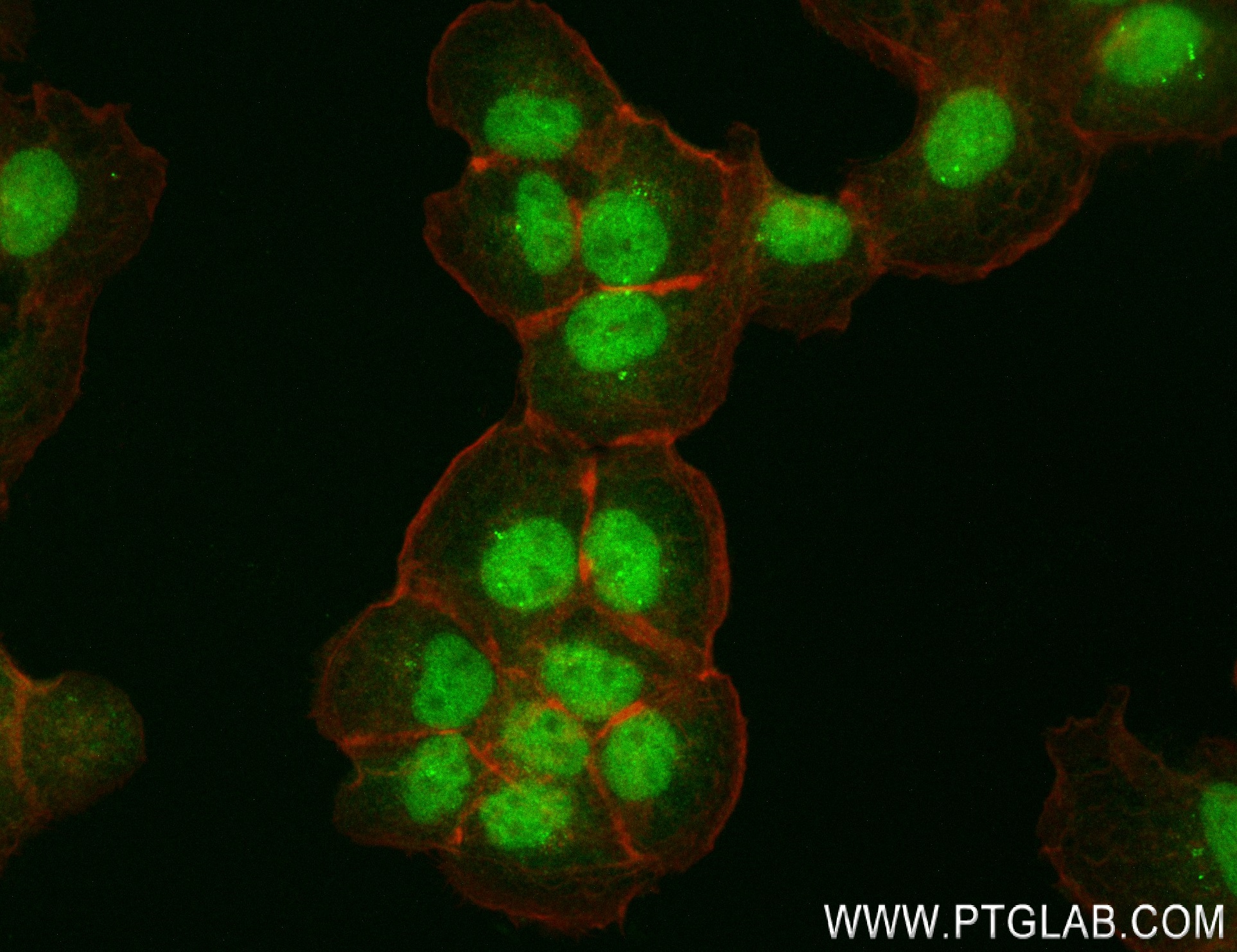 IF Staining of A431 using 84314-3-RR