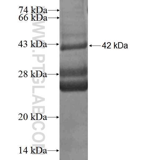 ALKBH3 fusion protein Ag2982 SDS-PAGE