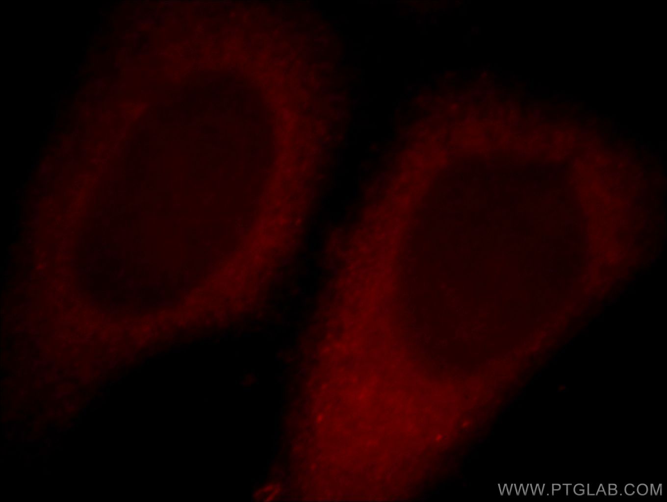 IF Staining of HepG2 using 19882-1-AP