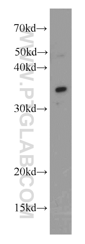 ALKBH4 Polyclonal antibody