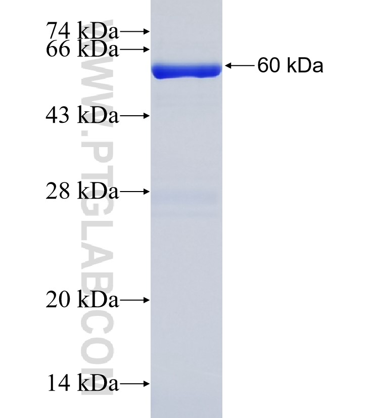 ALKBH4 fusion protein Ag7764 SDS-PAGE