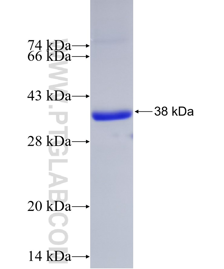 ALKBH4 fusion protein Ag8041 SDS-PAGE