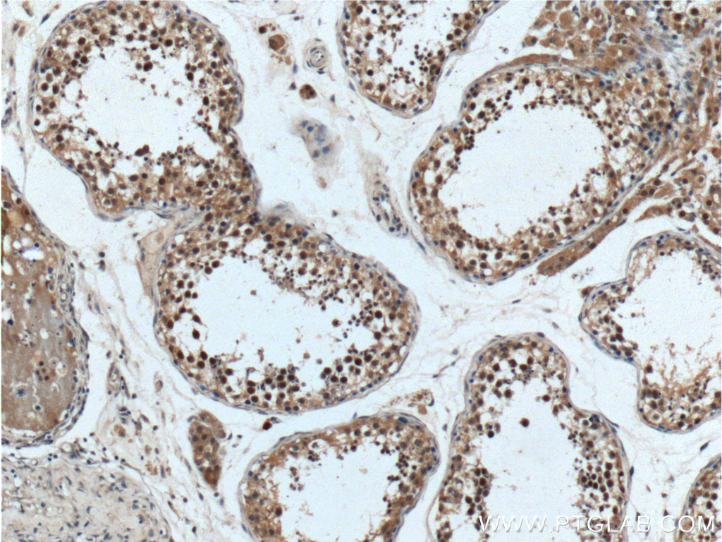 IHC staining of human testis using 16837-1-AP