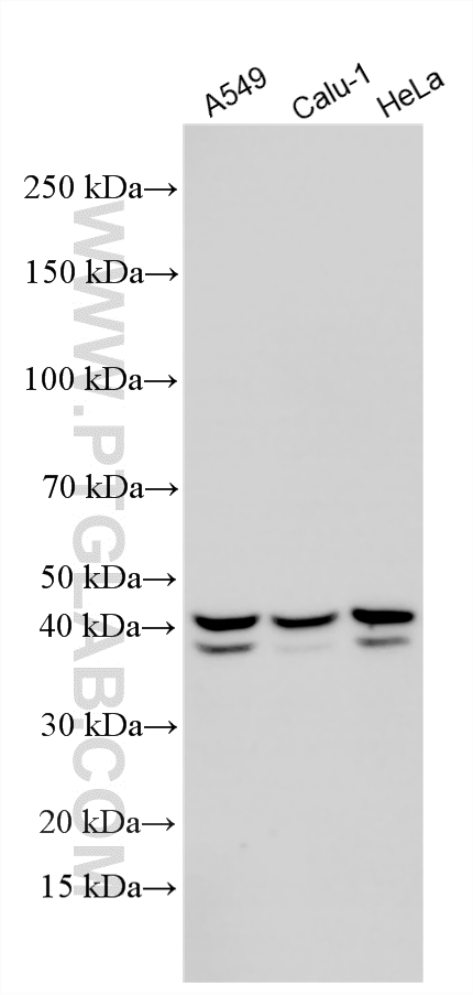 Various lysates were subjected to SDS PAGE followed by western blot with 16837-1-AP (ALKBH5 antibody) at dilution of 1:20000 incubated at room temperature for 1.5 hours. WB analysis using 16837-1-AP
