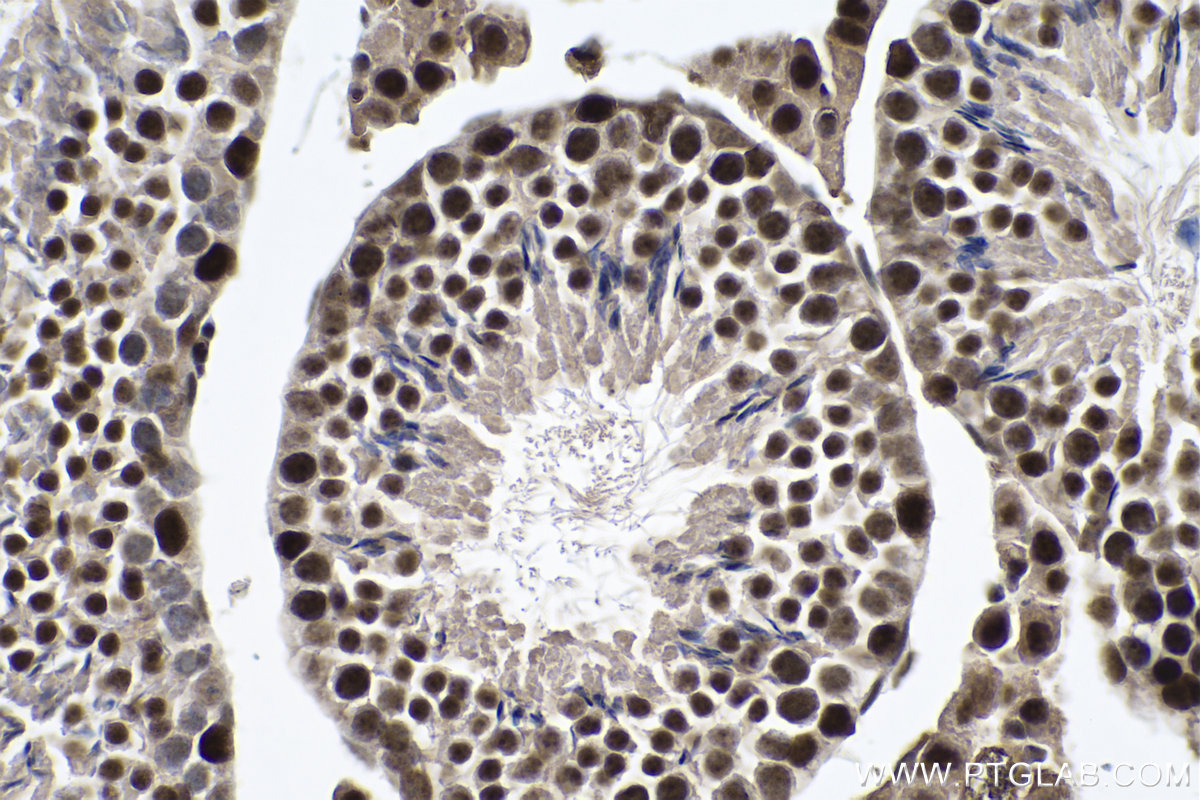 IHC staining of mouse testis using 67811-1-Ig