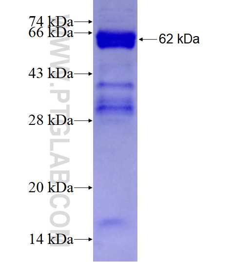 ALKBH5 fusion protein Ag10516 SDS-PAGE