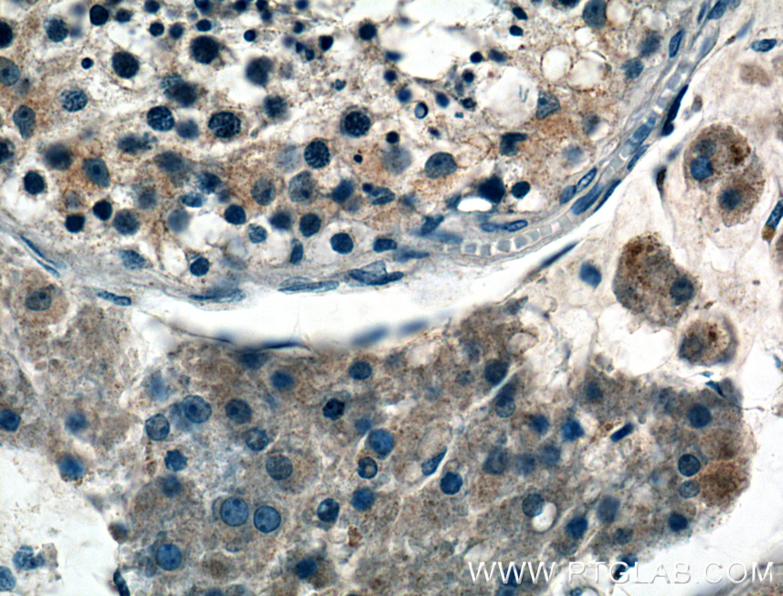 IHC staining of human testis using 21464-1-AP