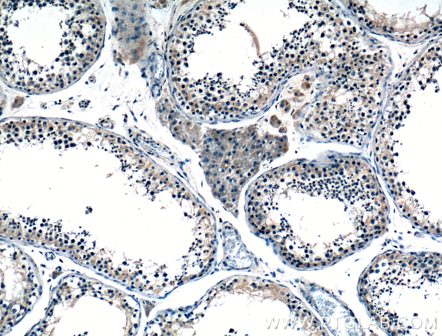IHC staining of human testis using 21464-1-AP