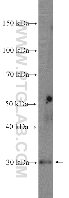 WB analysis of mouse pancreas using 21464-1-AP
