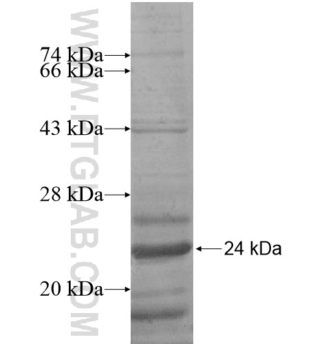ALKBH6 fusion protein Ag15061 SDS-PAGE ALKBH6 fusion protein Ag15061 SDS-PAGE