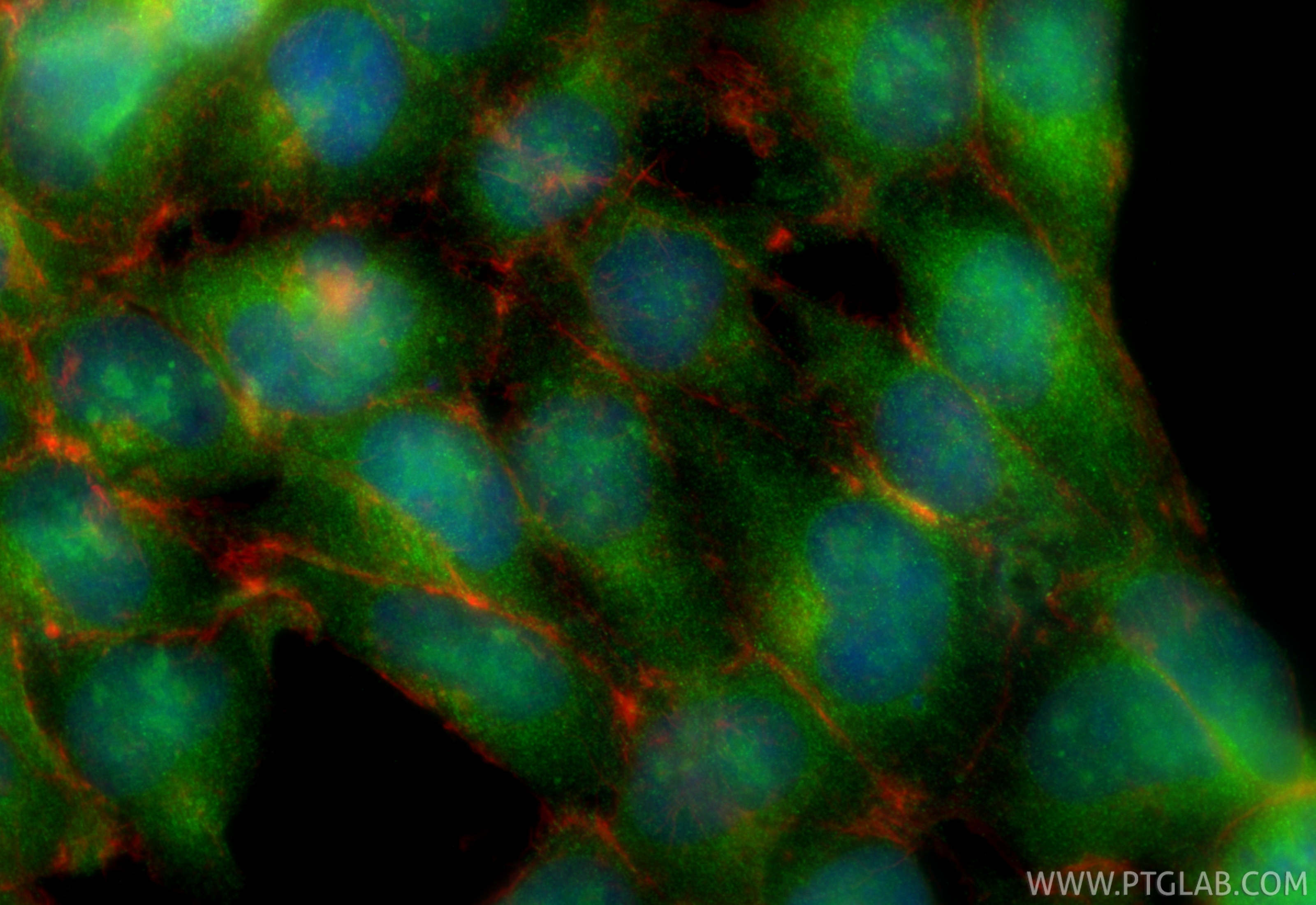 IF Staining of HEK-293 using 25566-1-AP