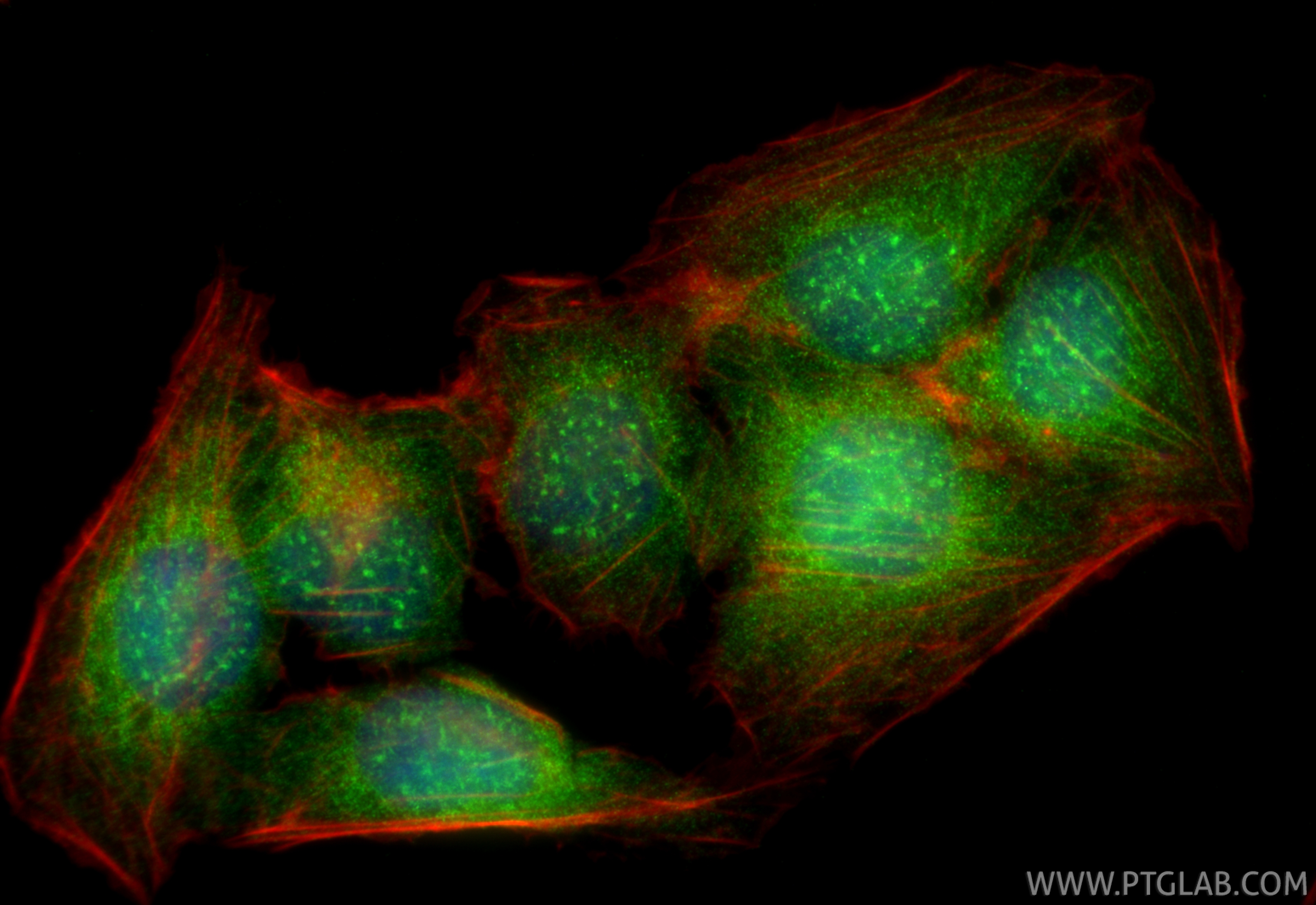 IF Staining of U2OS using 25566-1-AP