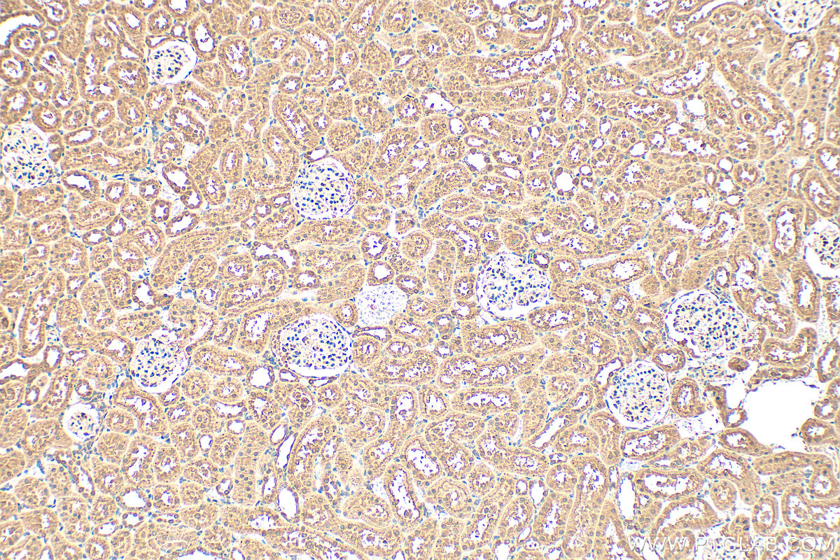 IHC staining of rat kidney using 25566-1-AP