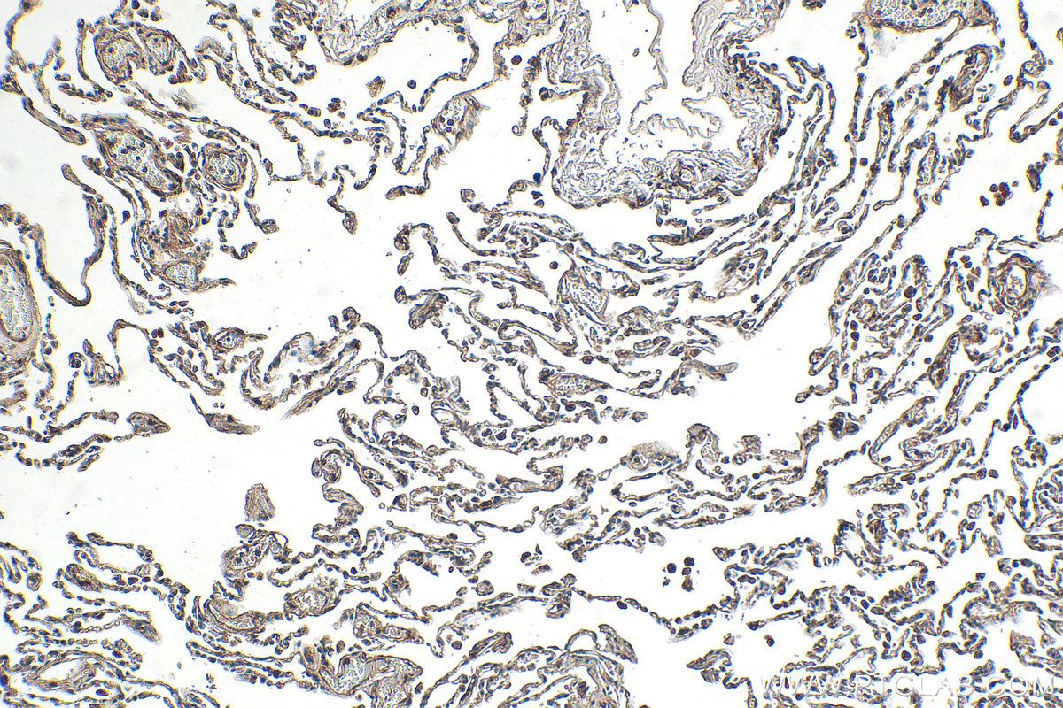Immunohistochemical analysis of paraffin-embedded human lung tissue slide using 27231-1-AP (ALMS1 antibody) at dilution of 1:200 (under 10x lens). Heat mediated antigen retrieval with Tris-EDTA buffer (pH 9.0). IHC staining of human lung using 27231-1-AP