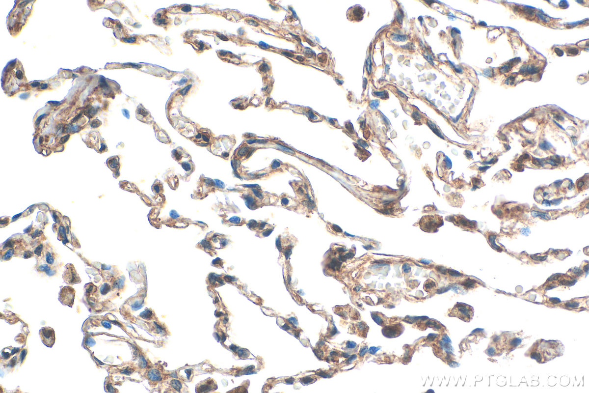 Immunohistochemical analysis of paraffin-embedded human lung tissue slide using 27231-1-AP (ALMS1 antibody) at dilution of 1:200 (under 40x lens). Heat mediated antigen retrieval with Tris-EDTA buffer (pH 9.0). IHC staining of human lung using 27231-1-AP