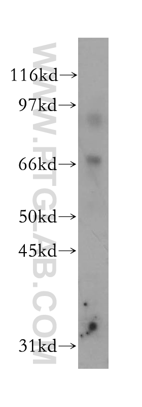 15 Lipoxygenase 2