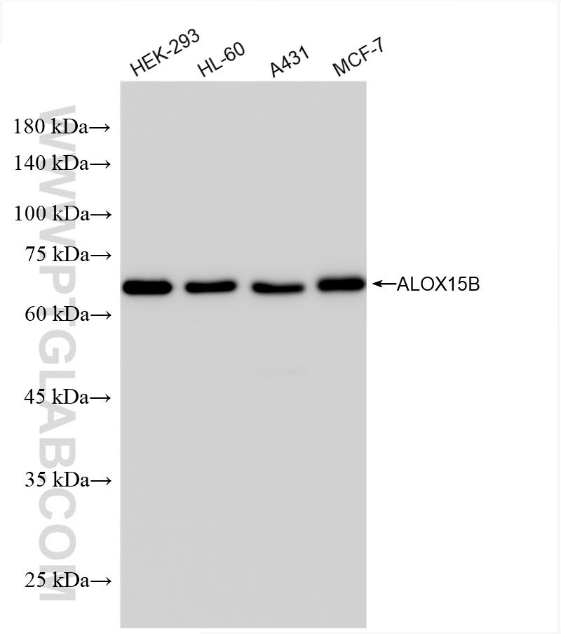 WB analysis using 86146-1-RR (same clone as 86146-1-PBS)
