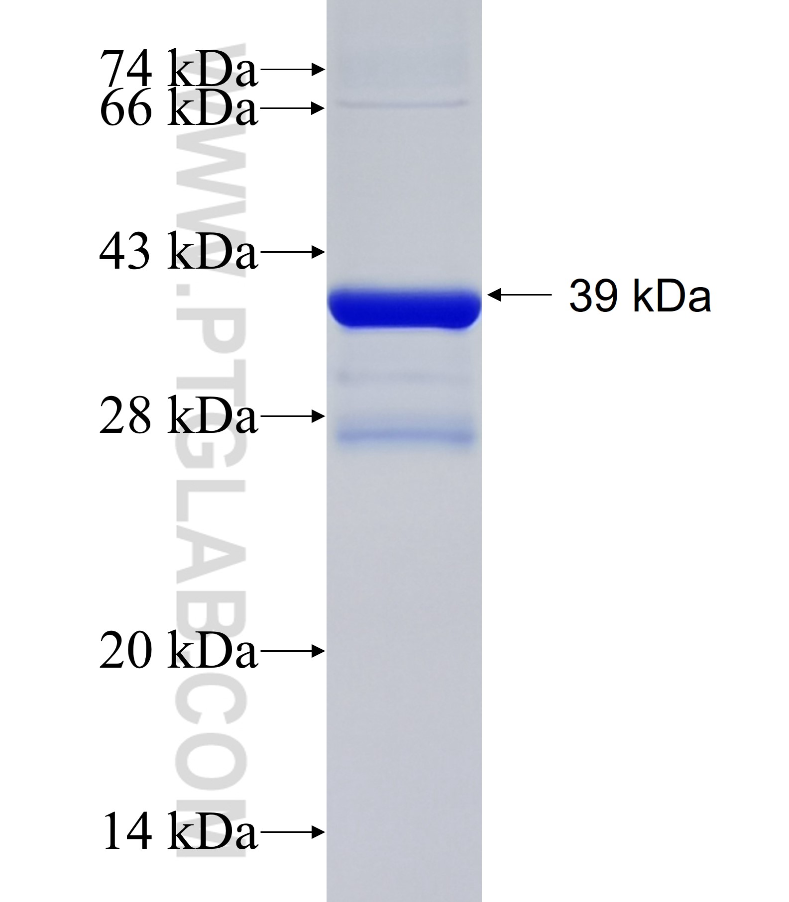 ALPK3 fusion protein Ag34667 SDS-PAGE