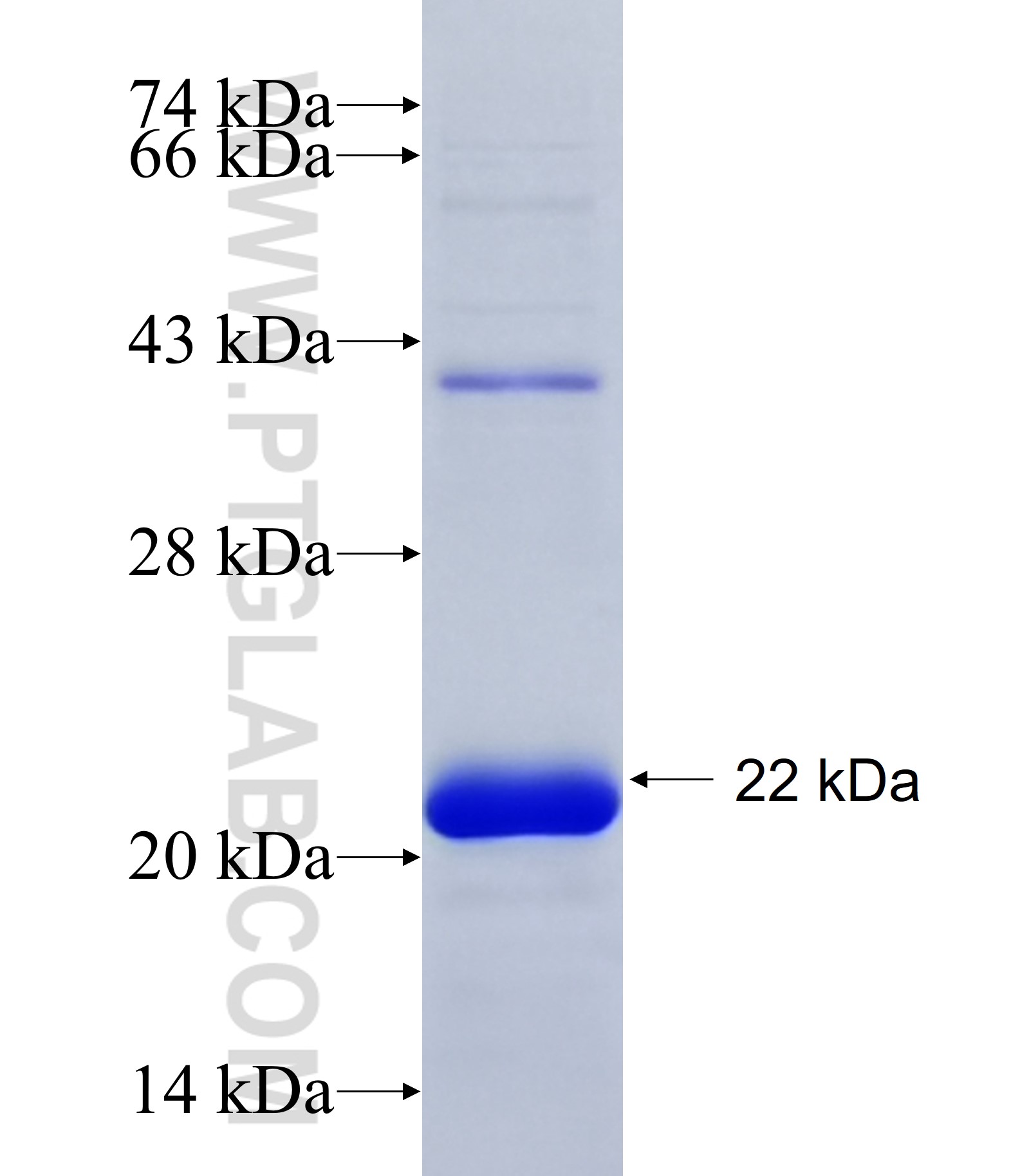 ALPK3 fusion protein Ag34720 SDS-PAGE