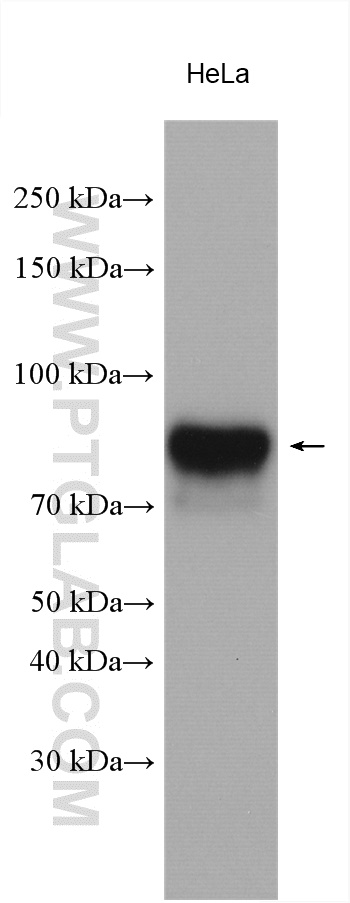 WB analysis using 11187-1-AP