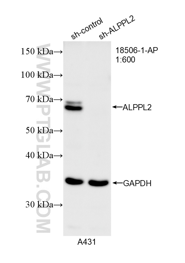 WB analysis of A431 using 18506-1-AP WB analysis of A431 using 18506-1-AP