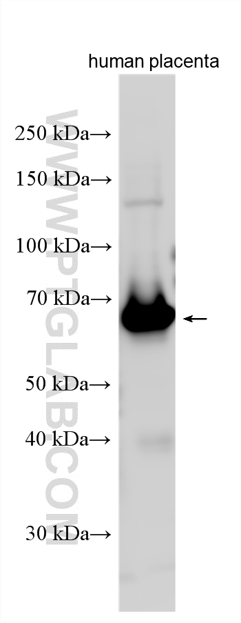 WB analysis using 18506-1-AP WB analysis using 18506-1-AP