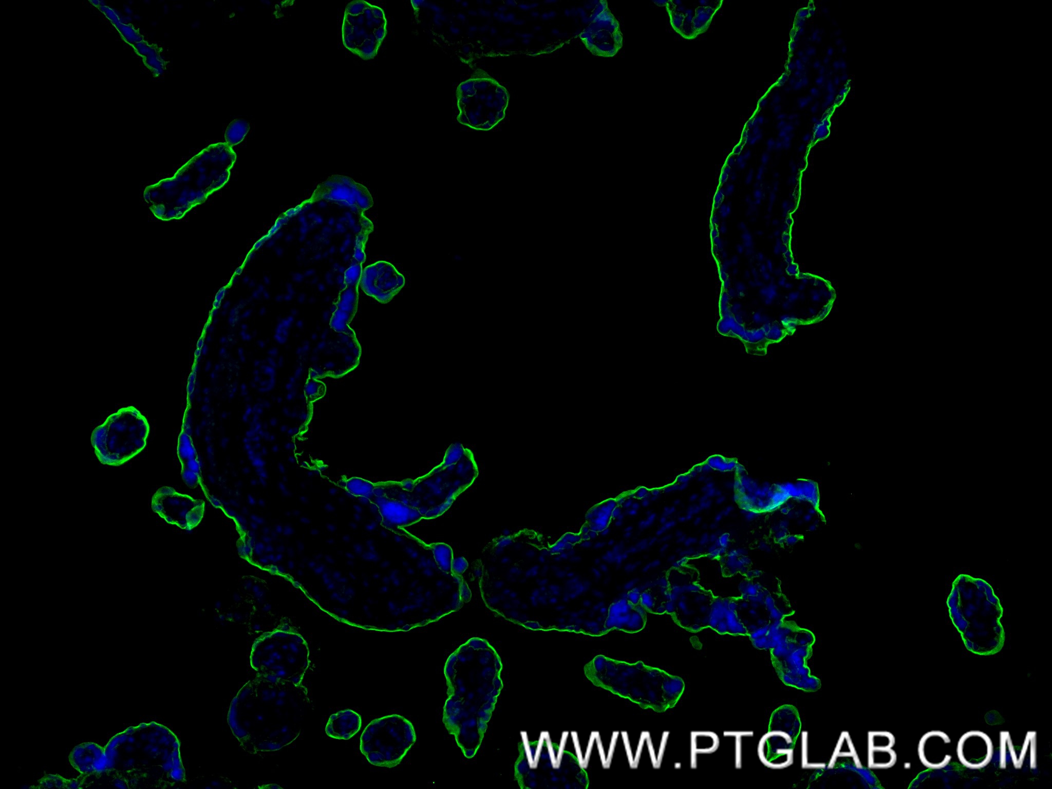 IF Staining of human placenta using 84813-1-RR