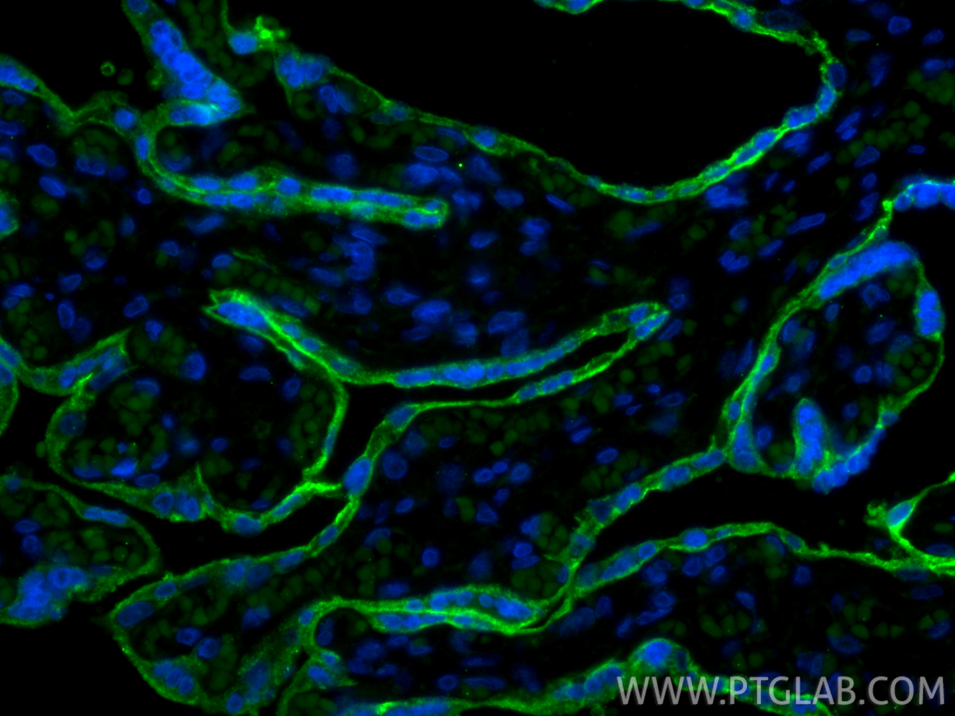 Immunofluorescent analysis of (4% PFA) fixed paraffin-embedded human placenta tissue using CoraLite® Plus 488 ALPPL2 antibody (CL488-84813, Clone: 241867A12 ) at dilution of 1:200. Heat mediated antigen retrieval with Tris-EDTA buffer (pH 9.0). IF Staining of human placenta using CL488-84813