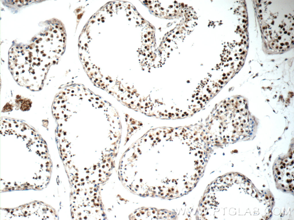 IHC staining of human testis using 13434-1-AP