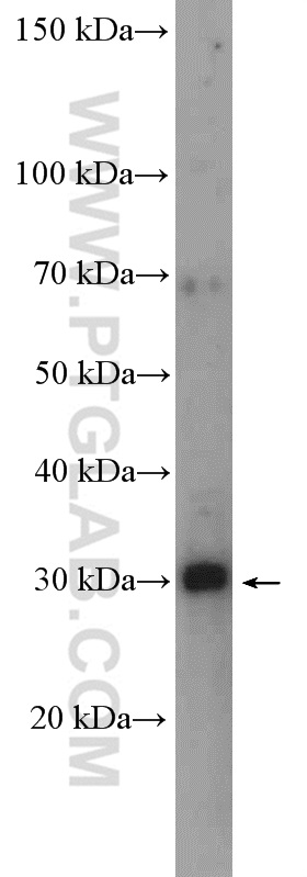 WB analysis of HeLa using 16690-1-AP