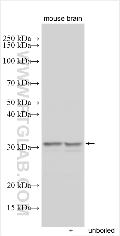 WB analysis using 30635-1-AP