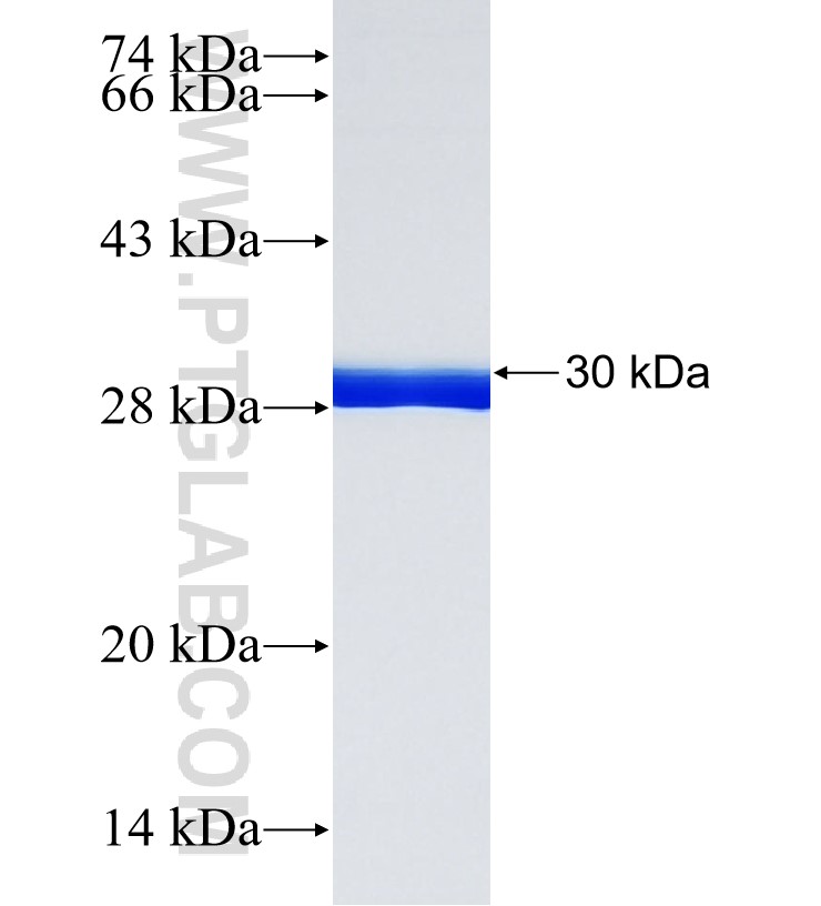 AMAC1L2 fusion protein Ag34353 SDS-PAGE AMAC1L2 fusion protein Ag34353 SDS-PAGE