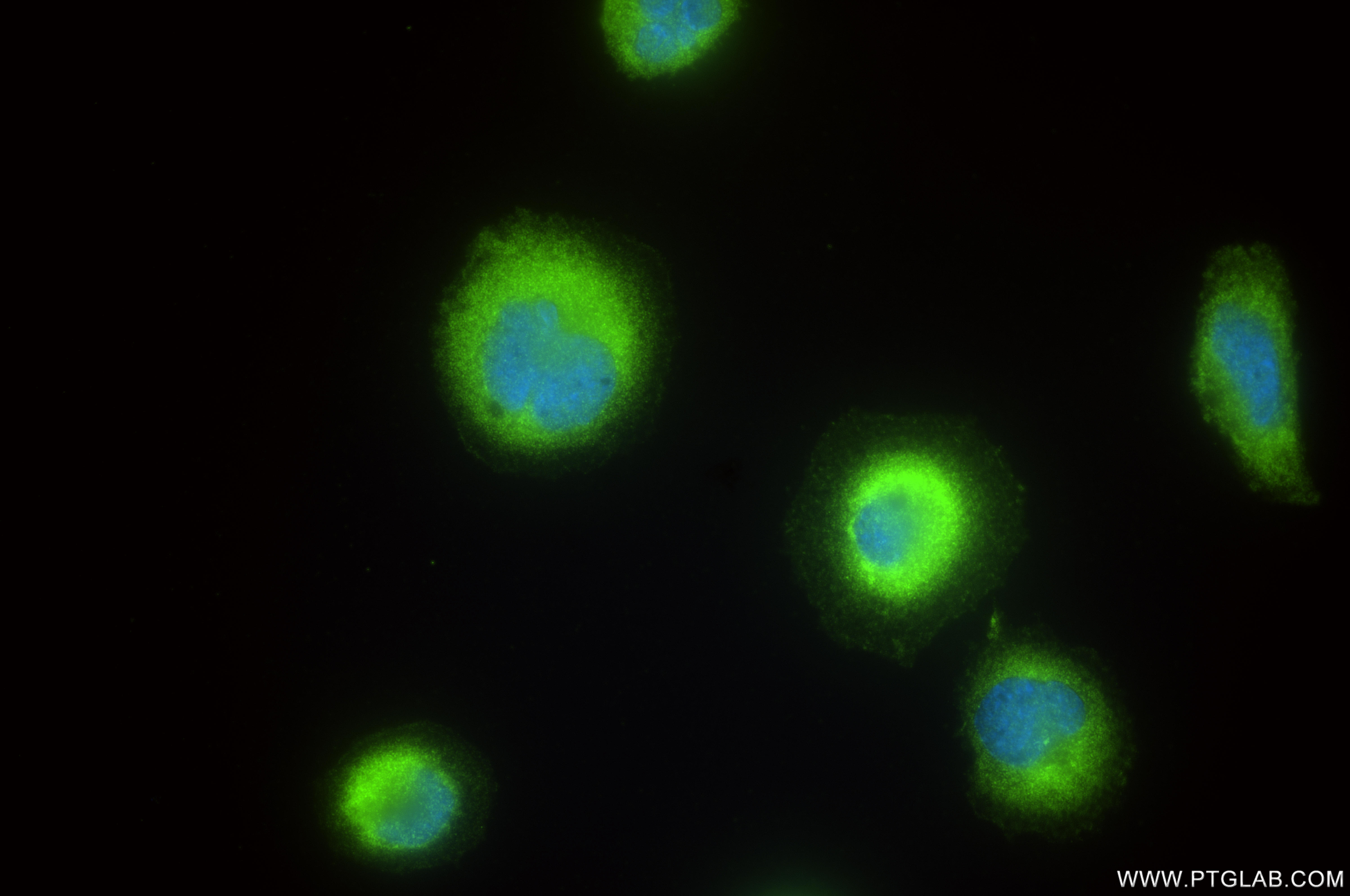 IF Staining of DU 145 using 84891-8-RR (same clone as 84891-8-PBS) IF Staining of DU 145 using 84891-8-RR (same clone as 84891-8-PBS)