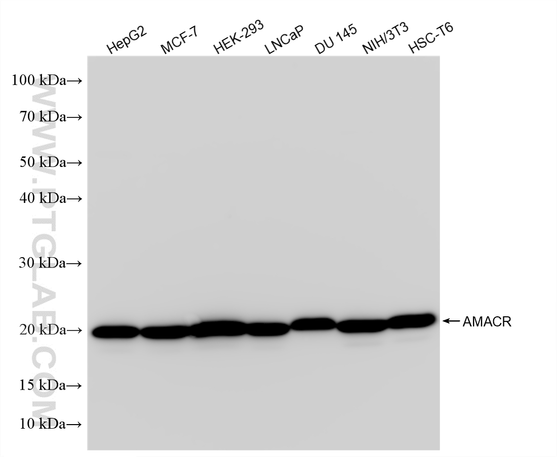 WB analysis using 84891-8-RR (same clone as 84891-8-PBS) WB analysis using 84891-8-RR (same clone as 84891-8-PBS)
