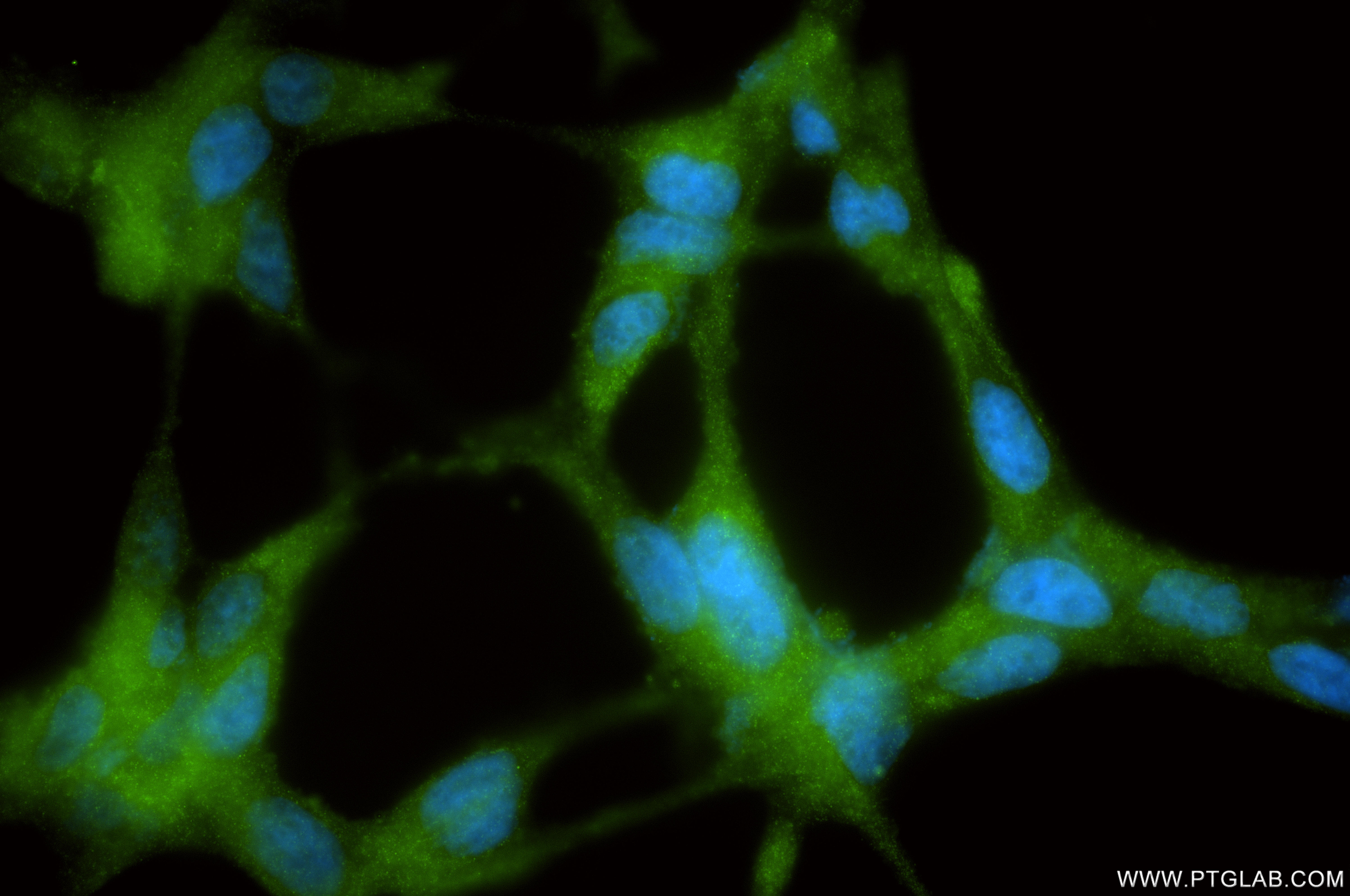 IF Staining of LNCaP using 84891-9-RR (same clone as 84891-9-PBS) IF Staining of LNCaP using 84891-9-RR (same clone as 84891-9-PBS)