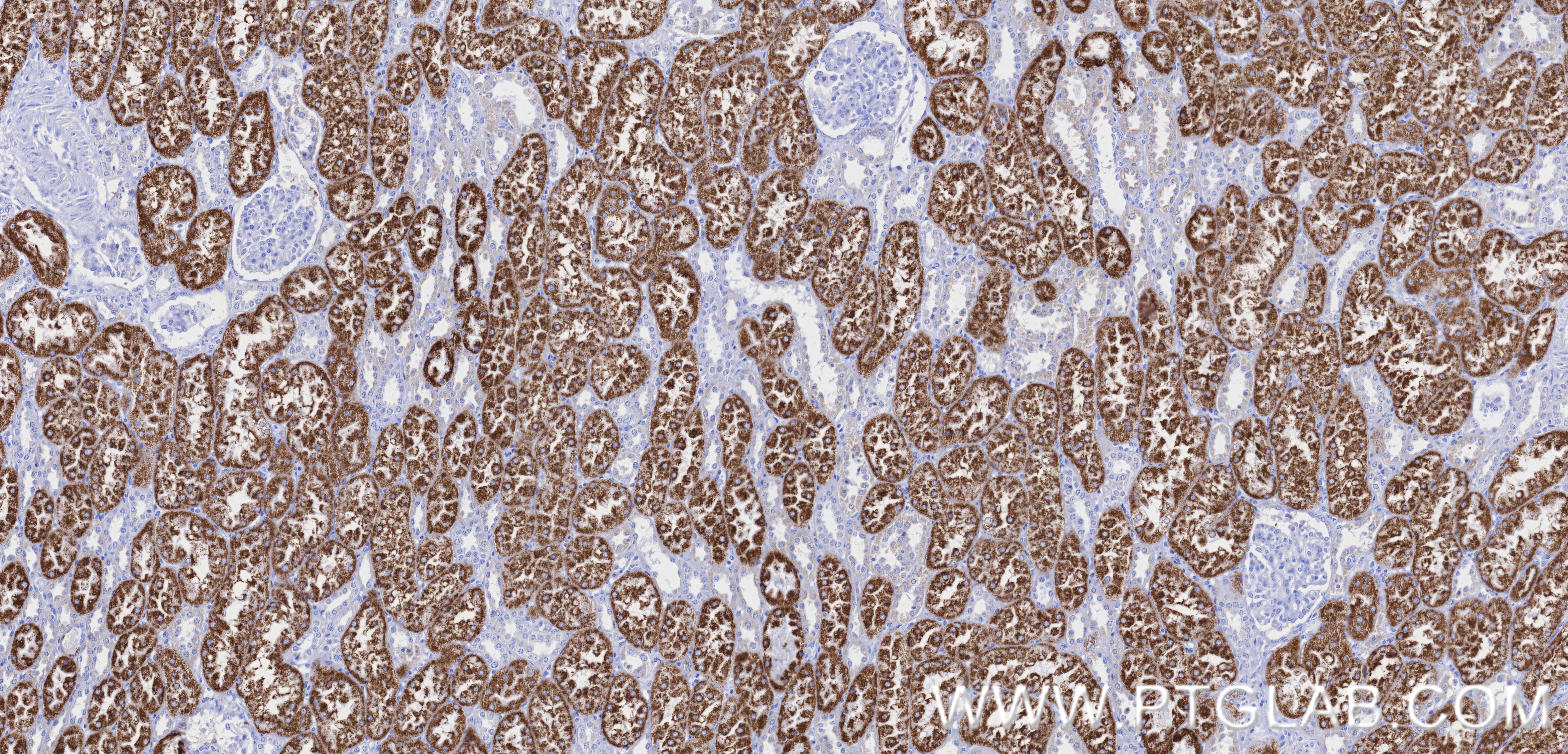 IHC staining of human kidney using 84891-2-RR