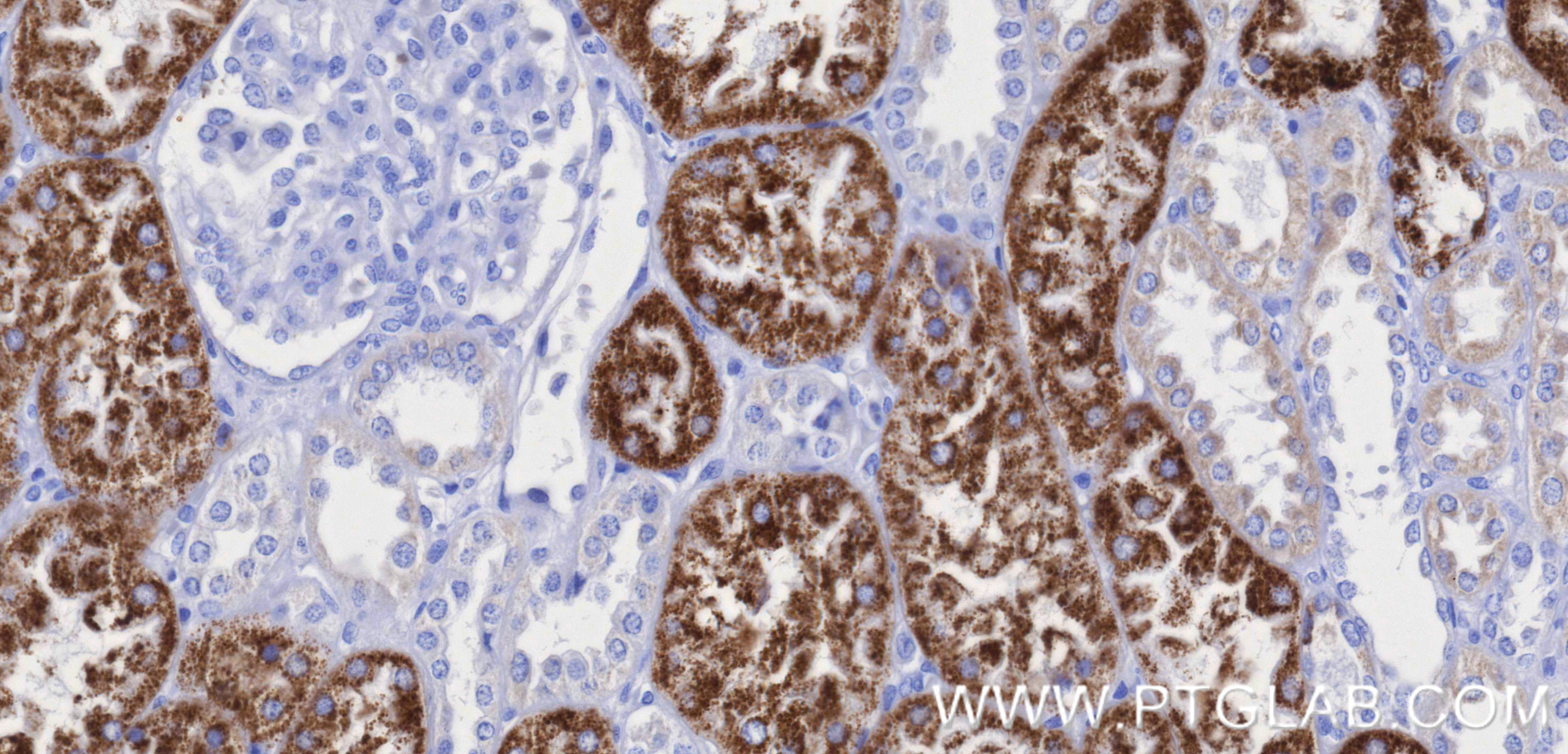 IHC staining of human kidney using 84891-2-RR