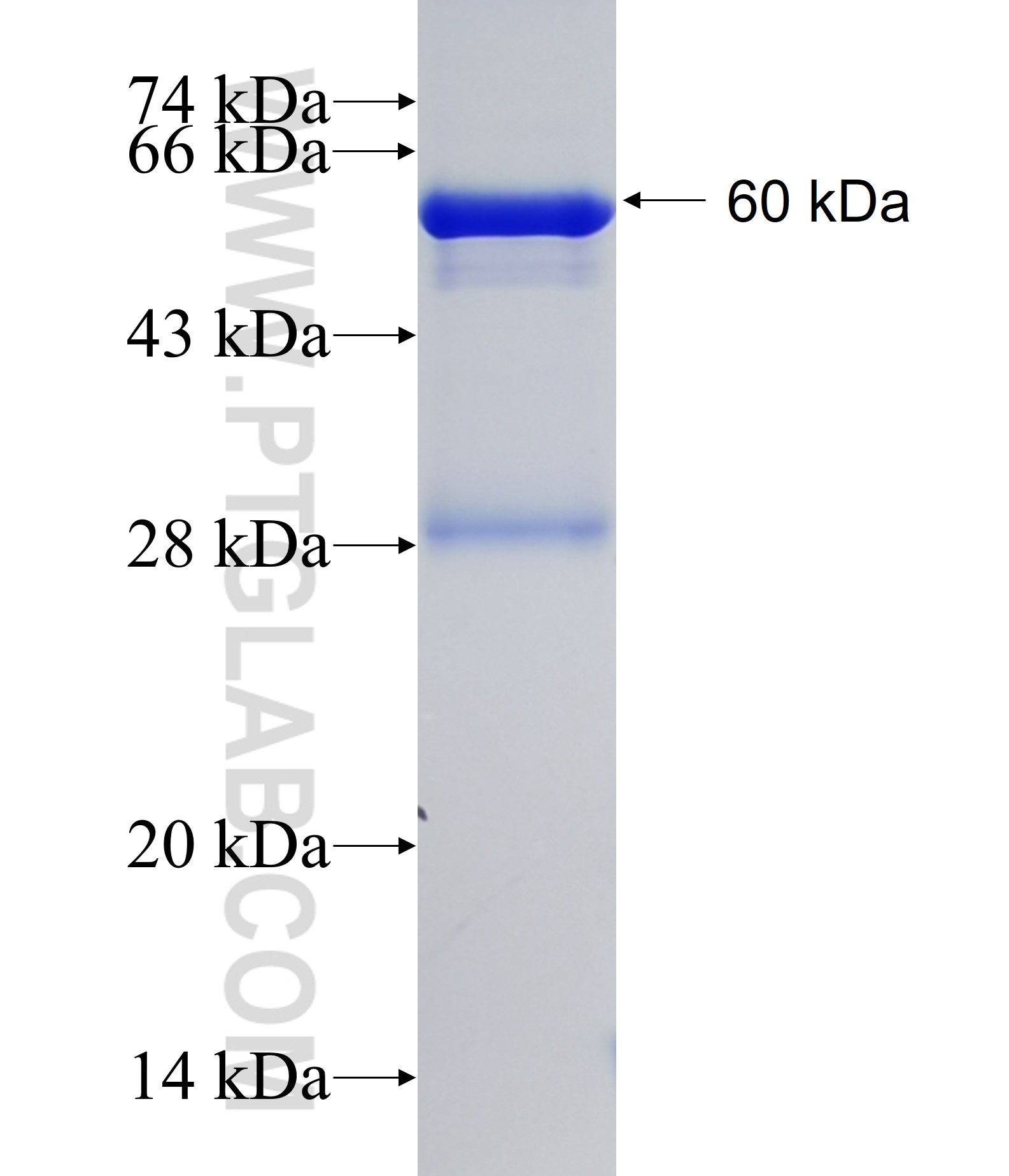 AMDHD2 fusion protein Ag22757 SDS-PAGE