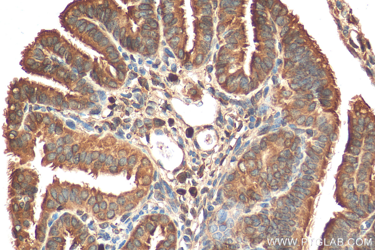 IHC staining of mouse ovary using 16675-1-AP