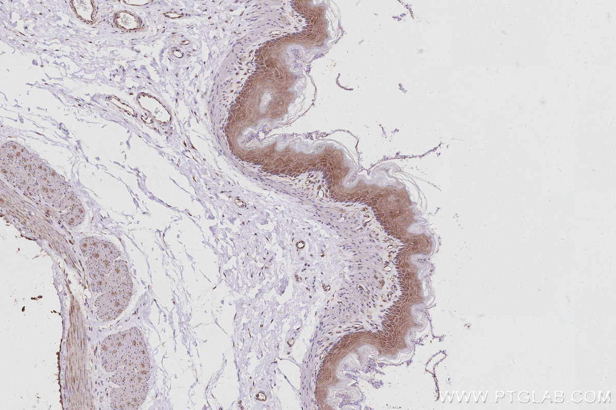 IHC staining of rat stomach using 16675-1-AP IHC staining of rat stomach using 16675-1-AP