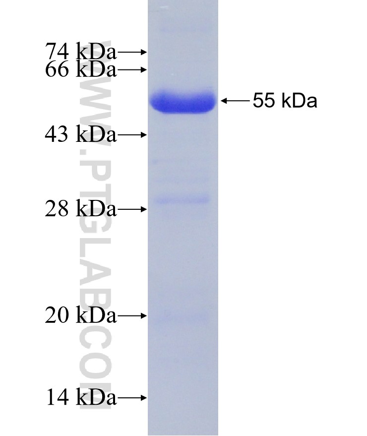 AMFR fusion protein Ag10308 SDS-PAGE