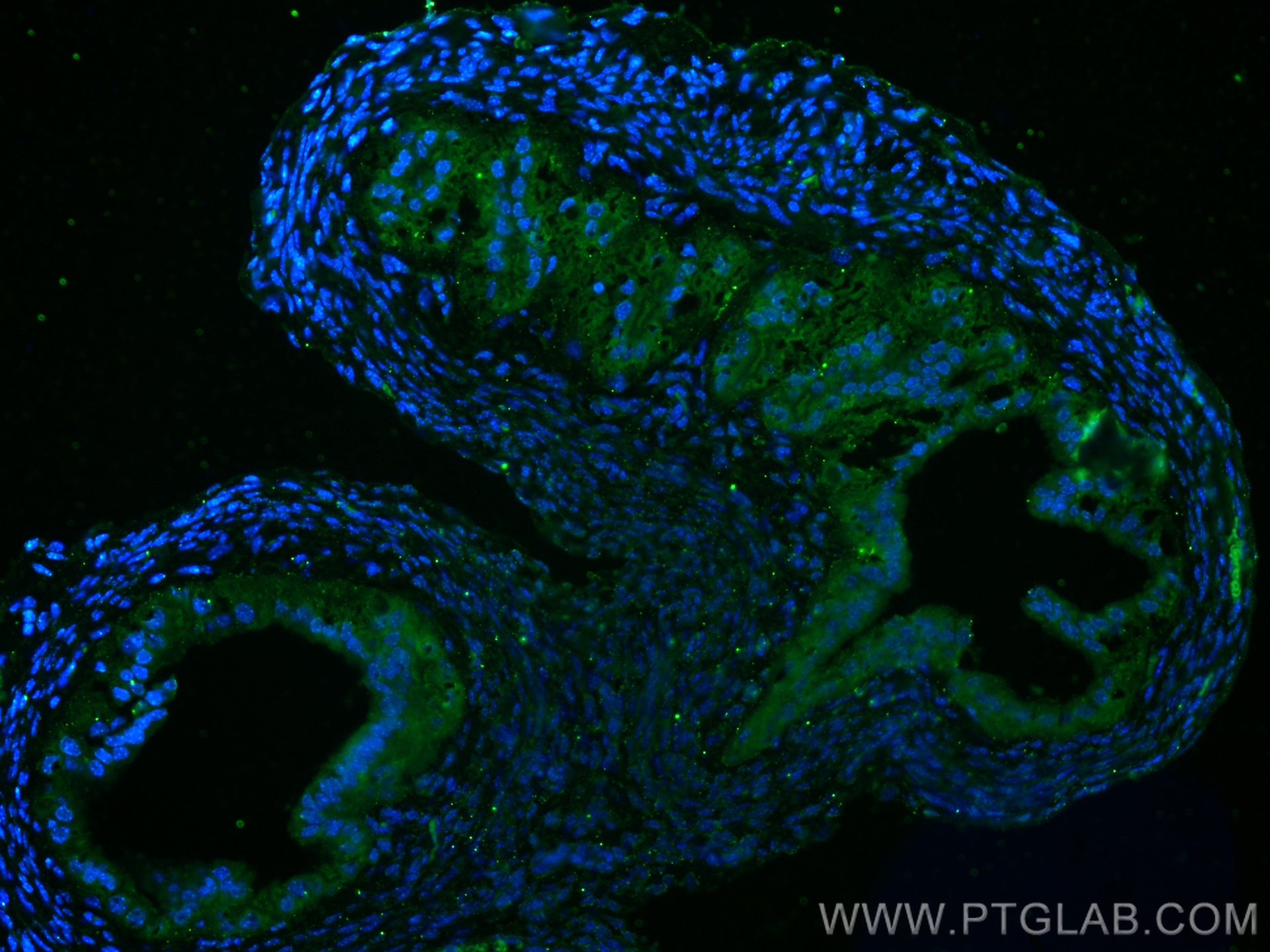 IF Staining of mouse ovary using 14461-1-AP