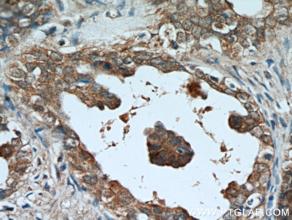 AMH Polyclonal antibody