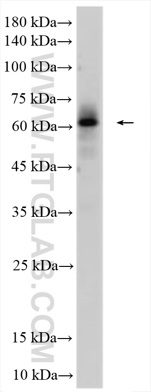 WB analysis of human testis using 14461-1-AP