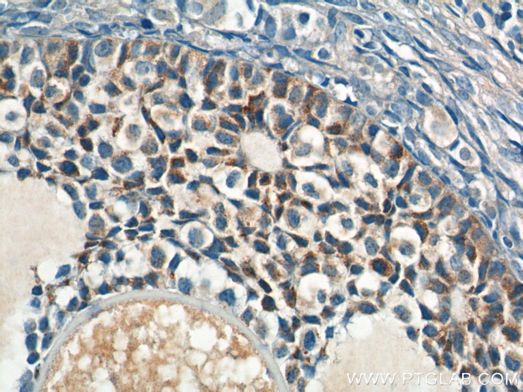 AMH Polyclonal antibody